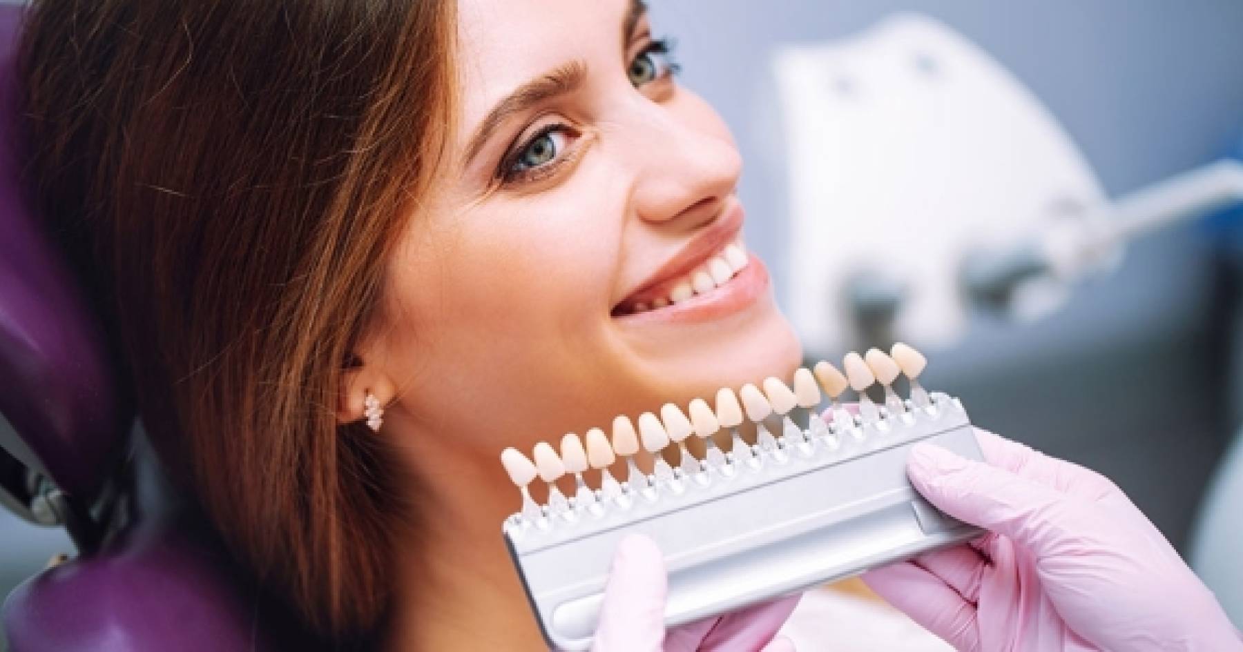 Tutto Quello che Devi Sapere sulle Faccette Dentali: Come Trasformare il Tuo Sorriso